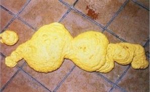 膵臓機能不全のマーカーは何ですか?